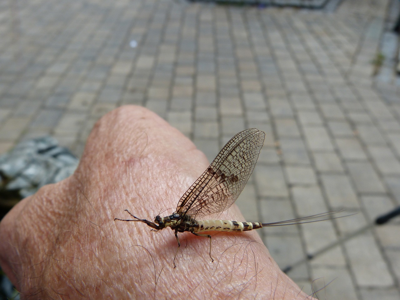 복부성형술